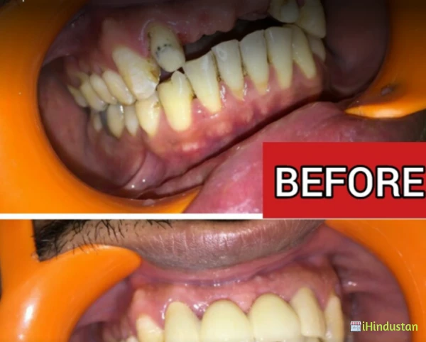 32 Smile Stone Dental Clinic and implant center - Logo