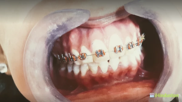 Aarav Dental Clinic - Logo