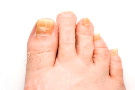 ACT Podiatry - Logo