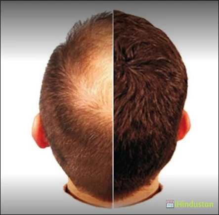 Adorable clinic Full Body Laser Hair Removal in Delhi - Logo