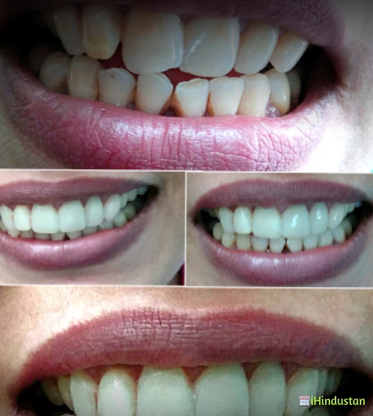 Advanced Dental Solutions: A Promise For Better Dentist - Logo