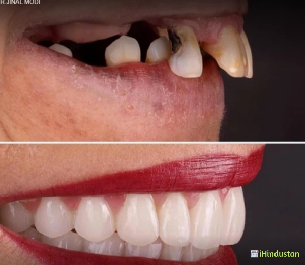 ADVANCE DENTAL CLINIC / DR.JINAL MODI - Logo