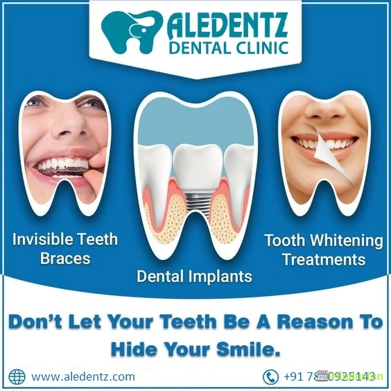 Aledentz Dental Implant & Orthodontic Center-Uttam Naga - Logo