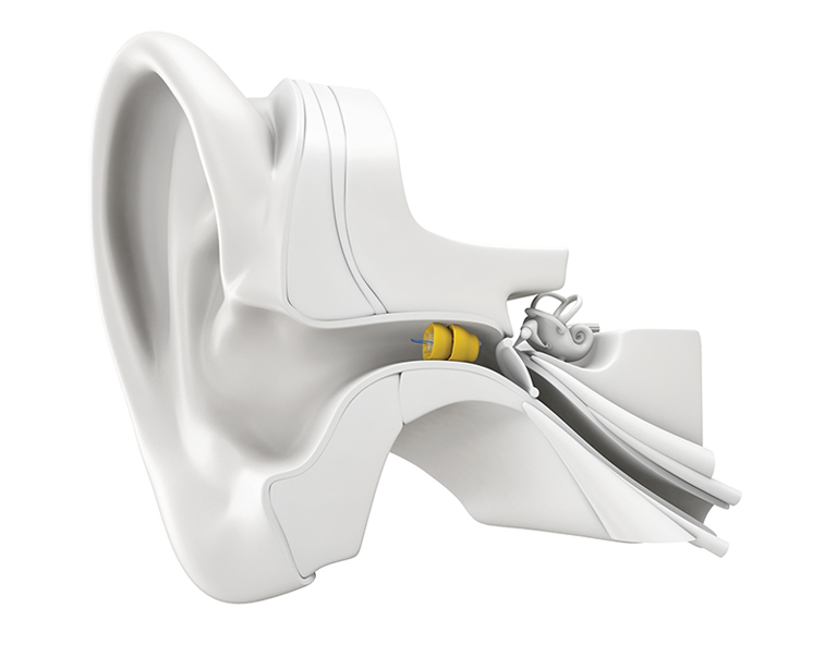 Alice Audiology - Logo