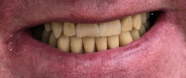 All Smiles Denture Clinic Bongaree - Cover photo