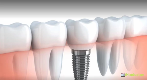 Anand Dental Clinic Dr. Rahul Agrawal - Logo