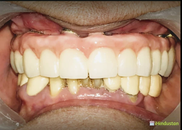 Apollo Dental Clinic - Logo
