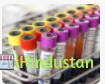 Apollo Diagnostics - Logo