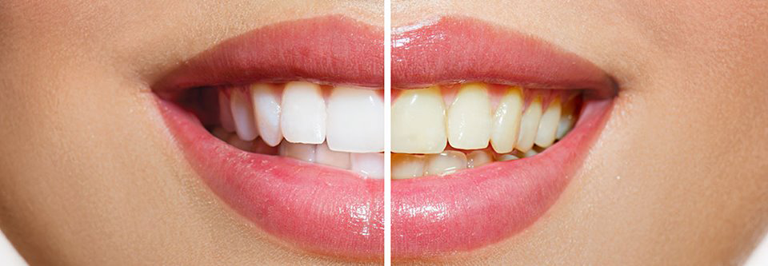 Aspire Dental - Cover photo