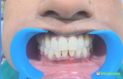 AVAN DENTAL CLINIC & IMPLANT CENTRE - Logo