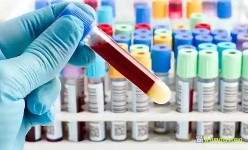 Avick Pathology Collection Centre Presented By Rapidx L - Logo