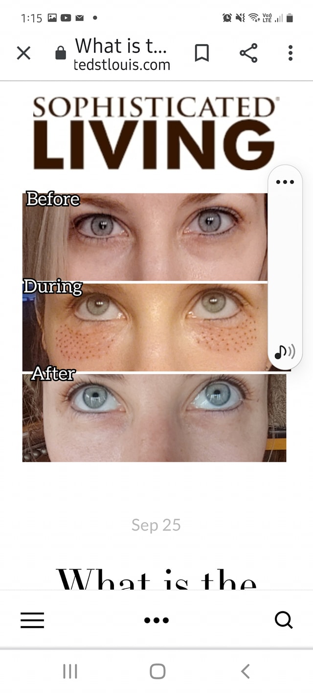 Avidius Rejuvenation Therapies - Cover photo