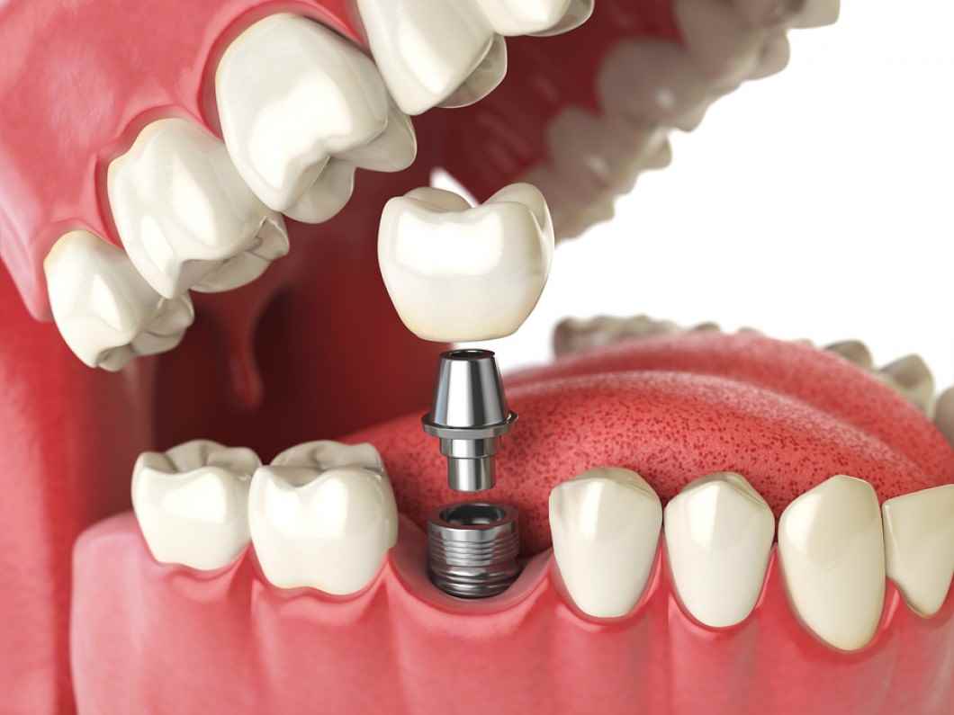 Bansal Dental Clinic - Cover photo