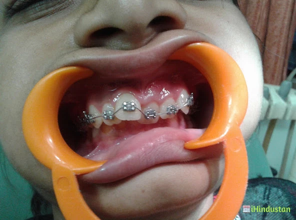 Baranwal Dental Clinic - Logo