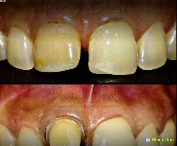 Baroda Dental - Logo