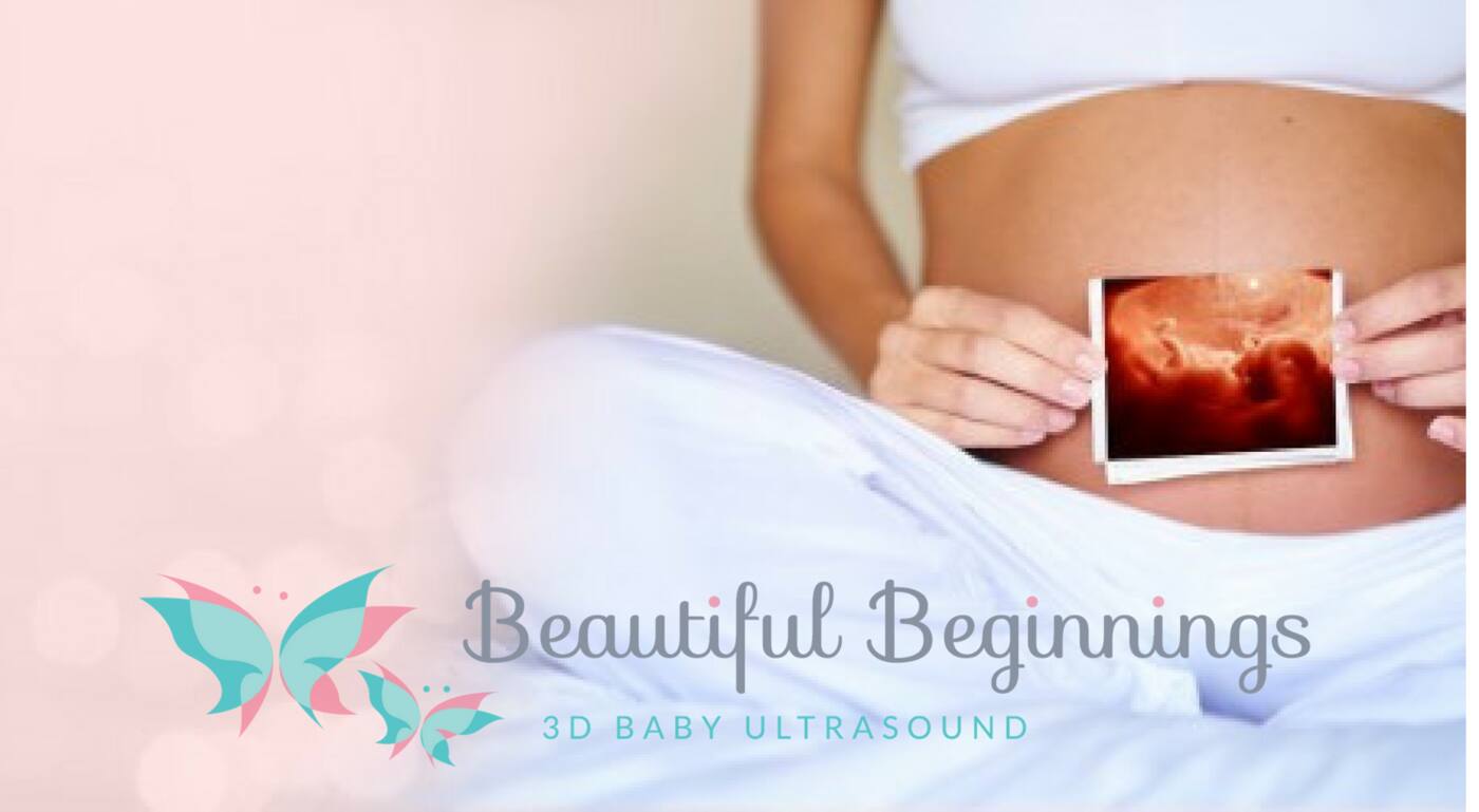 Beautiful Beginnings - Cover photo
