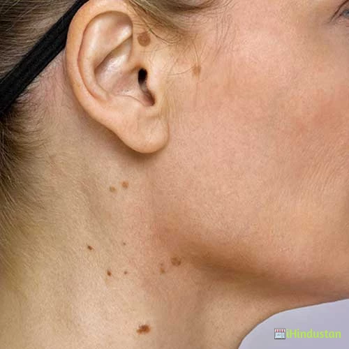 Berhampore Skin Care - Logo