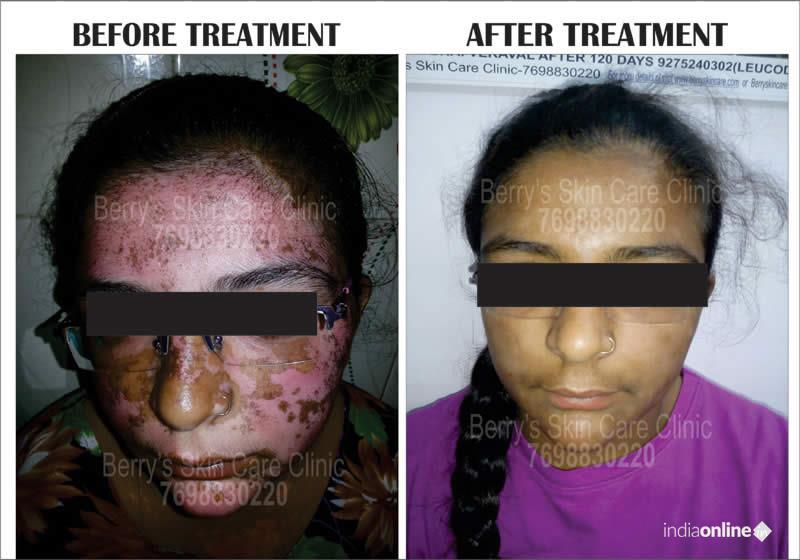 Berry Skin Care - Cover photo