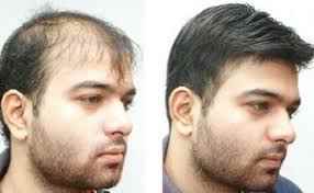 Best Dermatologist In Gurgaon - Cover photo