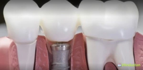 Bhanumati dental care and implant center - Logo
