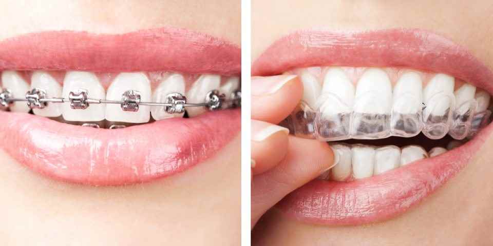 Braces And Roots Dental Clinic - Cover photo