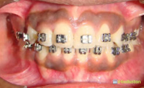 Braces N Gum Care Multi specialty Dental Clinic - Logo
