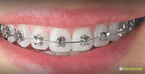 Bristles Dental Studios - Logo