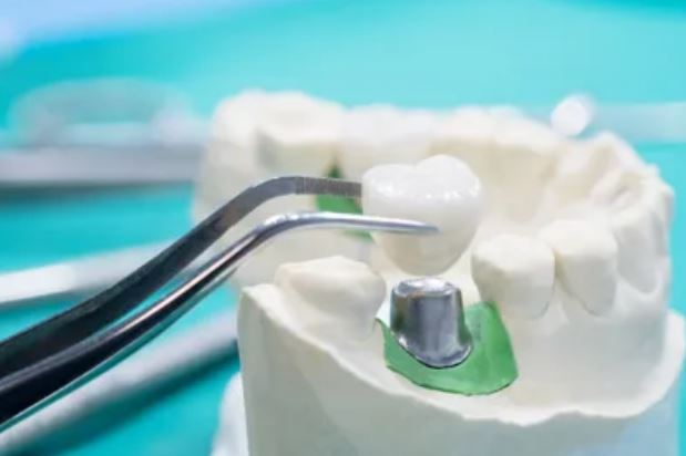 Bytes of Lennox Dental - Logo