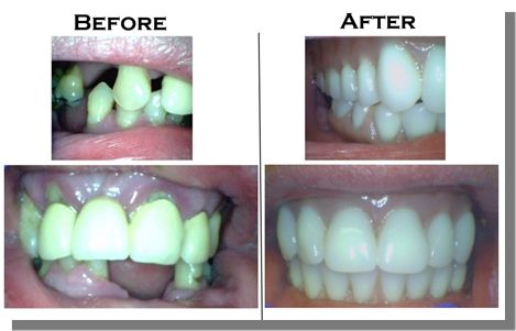 Canadian Denture Centres - Cover photo