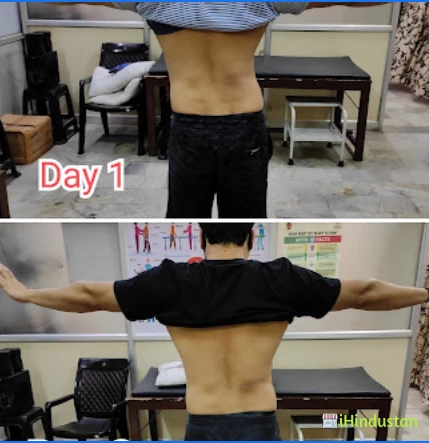 Center Spine Physiotherapy & Rehabilitation Centre - Logo