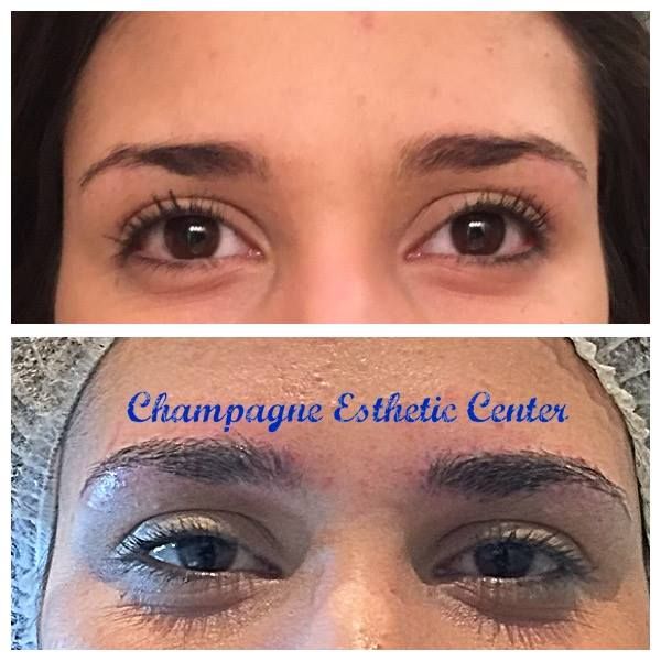 Champagne Esthetic Center - Cover photo
