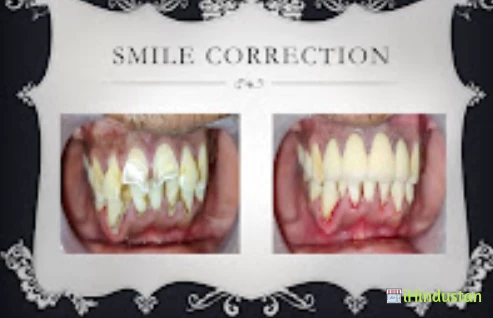Chaturvedi Dental clinic chhindwara - Logo