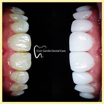 Civic Gentle Dental Care - Logo
