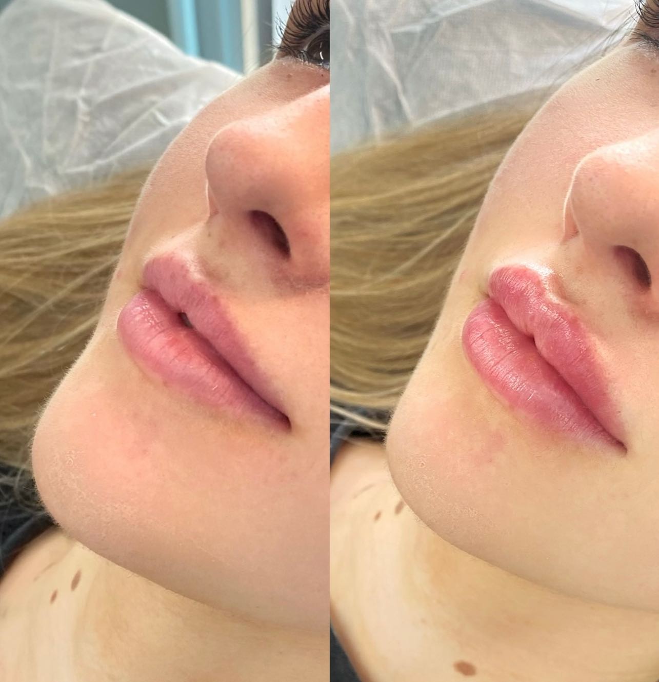 Cosmetic Injectables - Danielle Ryan - Logo