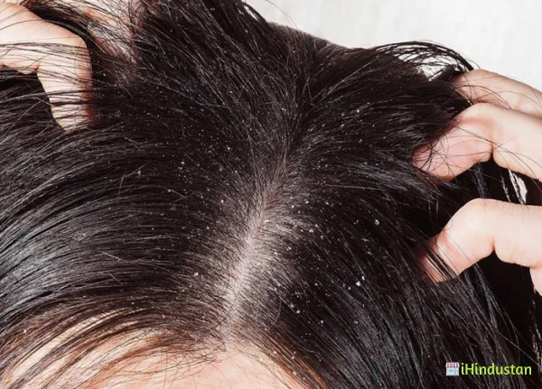 Dandruff treatment cost in Hyderabad - Logo