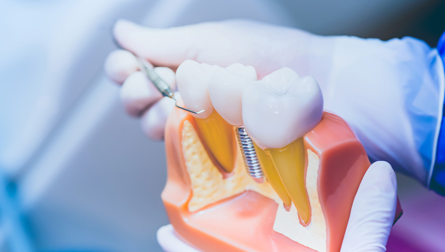 Davis Dental-Specialist Prosthodontist - Logo