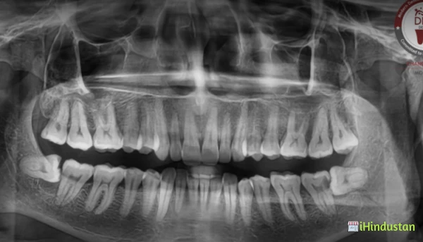 Deep Dental Clinic & OPG Centre - Logo