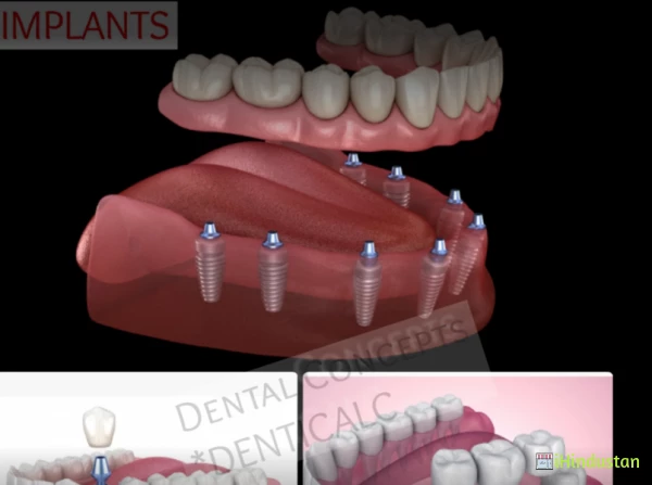 Dental Concepts - Logo
