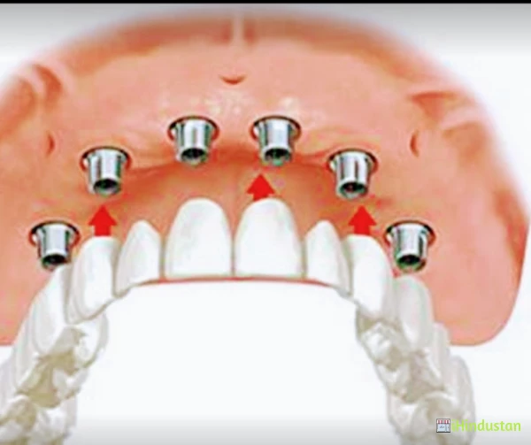 Dental Cure Dental Clinic & Implant Center - Logo