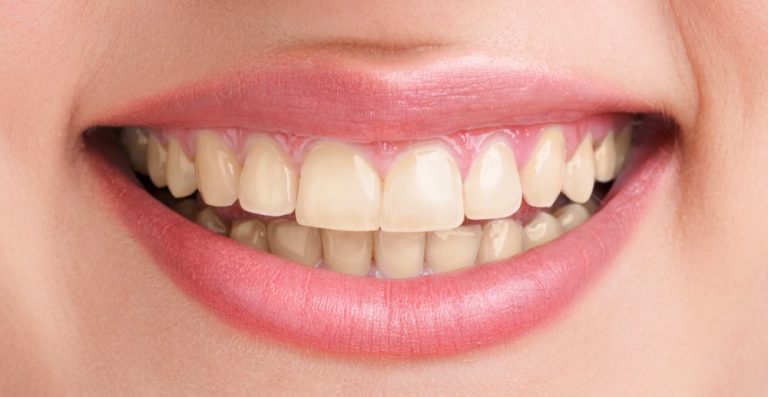 Dental Design Studio 32 - Logo