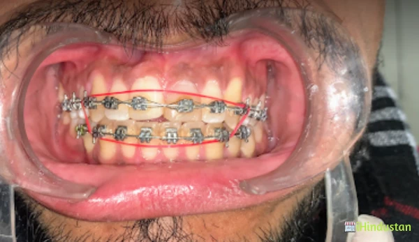 Dental Excellence-A Multispecialty - Logo
