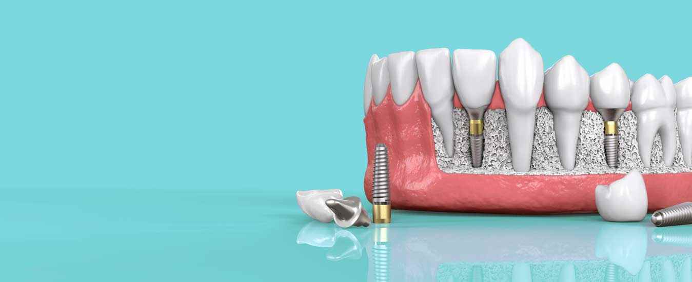 Dentistree Dental Centre - Cover photo