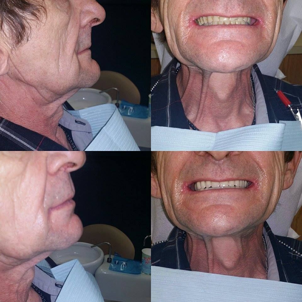 Denture Discount - Cover photo