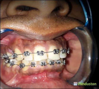 DEORI DENTAL CARE - Logo