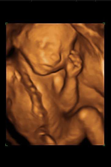 Discovery 3D Ultrasound - Logo