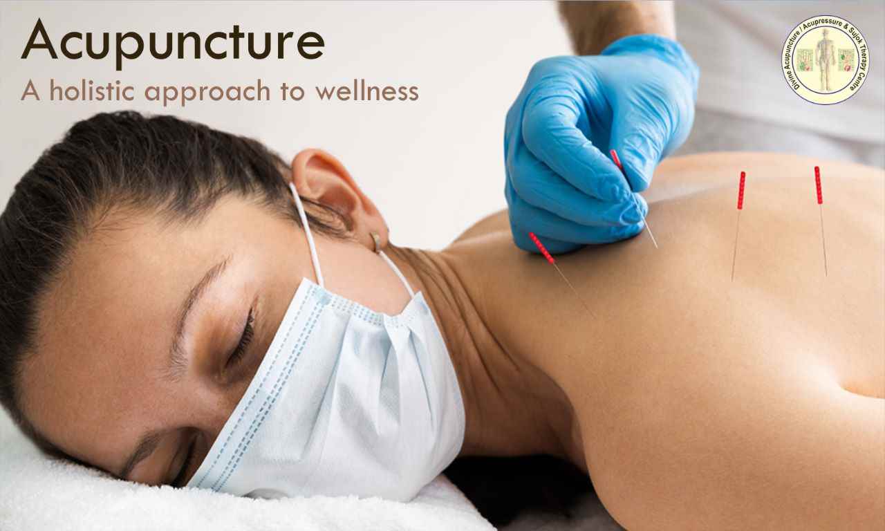 Divine Acupuncture - Cover photo