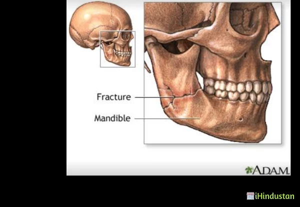 Dr Amit Bansal's Dental Implant - Logo