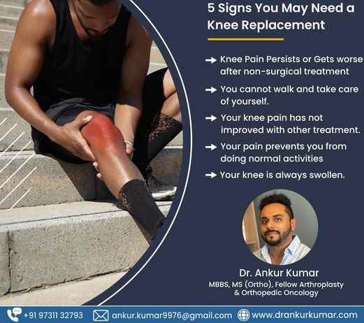 Dr Ankur Kumar Orthopedic Surgeon - Cover photo