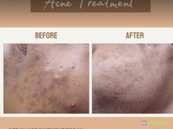 Dr BRINDA'S DERMALIFE SKIN AND HAIR CLINIC - Logo