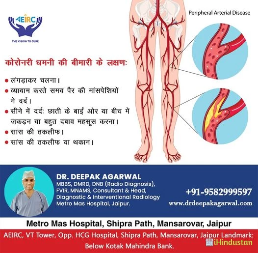 Dr Deepak Agarwal - Varicose Veins Doctor in Jaipur U - Logo